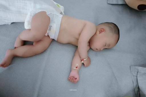 潍坊六个月宝宝眼睛散光